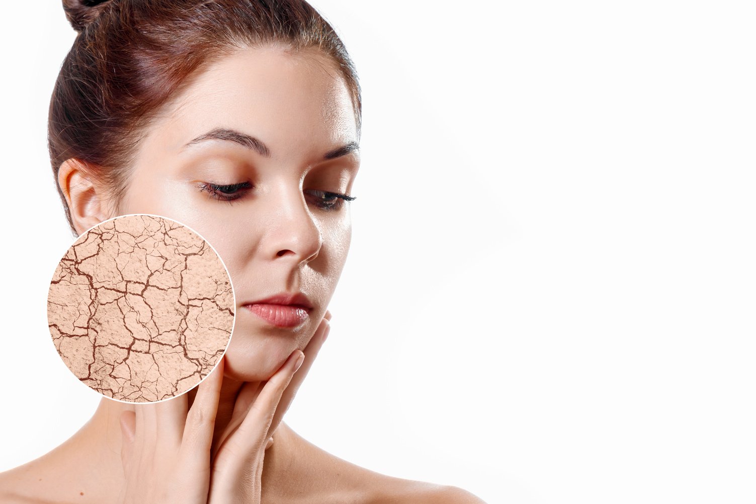 Zoom circle shows dry facial skin before moistening. Skin care concept. Young girl, beauty portrait. Close-up.